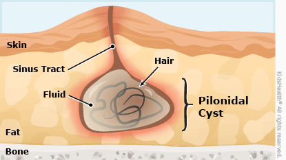 The Truth About Hair Removal, Preservation And Hair Loss Repair