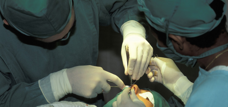 rhinoplasty-operation-748x350