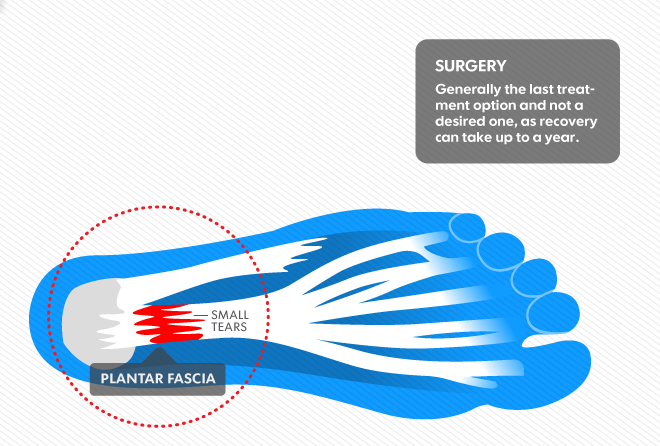 plantar2