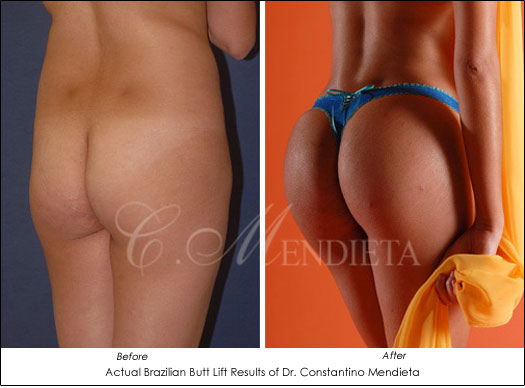 Big Buttocks: Where Does Our Obsession Come From?